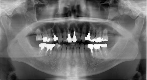 %e7%ae%b1%e5%b4%8e-%e8%a1%93%e5%89%8d%e3%80%80